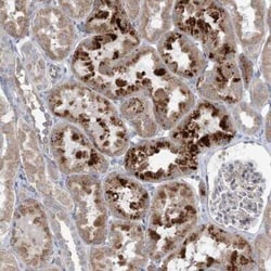 SCN11A Antibody, Novus Biologicals 25 &mu;L, Unconjugated:Antibodies, Polyclonal