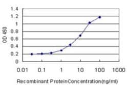 SCN3A Antibody (3F3), Novus Biologicals 0.1 mg, Unconjugated:Antibodies,