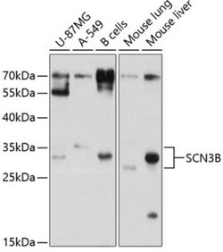SCN3B Antibody - BSA Free, Novus Biologicals 0.02 mL, Unconjugated:Antibodies,