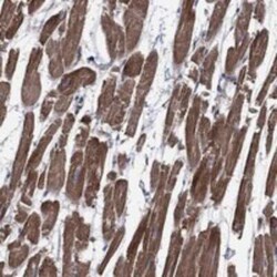 SCN7A Rabbit anti-Human, Polyclonal, Novus Biologicals 25 &mu;g; Unconjugated:Antibodies,
