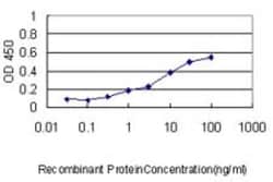 SCNM1 Antibody (1E10), Novus Biologicals 0.1 mg | Buy Online | Novus Biologicals | Fisher Scientific