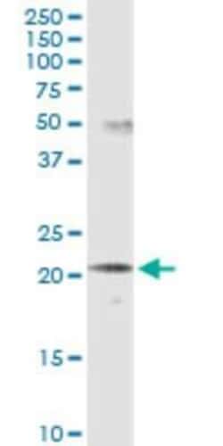 SCNM1 Antibody (1E10), Novus Biologicals 0.1 mg | Buy Online | Novus Biologicals | Fisher Scientific