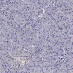 SCNN1D Antibody, Novus Biologicals 25 &mu;L; Unconjugated:Antibodies, Polyclonal