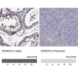 SCNN1D Antibody, Novus Biologicals 25 &mu;L; Unconjugated:Antibodies, Polyclonal