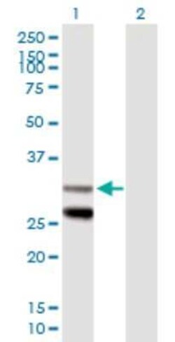 SCO1 Antibody, Novus Biologicals 50 &mu;g | Buy Online | Novus Biologicals | Fisher Scientific