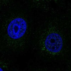 SCO2 Antibody, Novus Biologicals 25ul; Unconjugated:Antibodies, Polyclonal