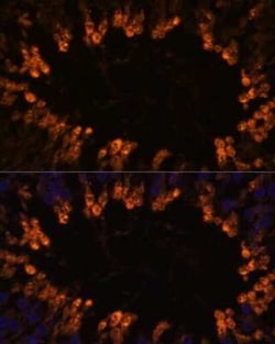 SCOT2 Antibody - Azide and BSA Free, Novus Biologicals:Antibodies:Primary