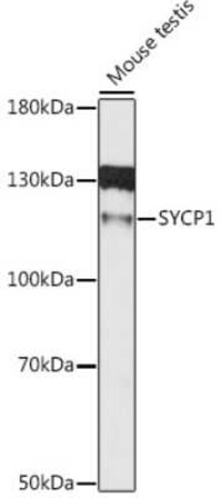 SCP1 Antibody - Azide and BSA Free, Novus Biologicals:Antibodies:Primary