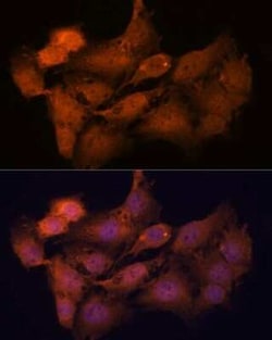 SCP2/SYCP2 Antibody - Azide and BSA Free, Novus Biologicals 0.1 mL; Unconjugated:Antibodies,