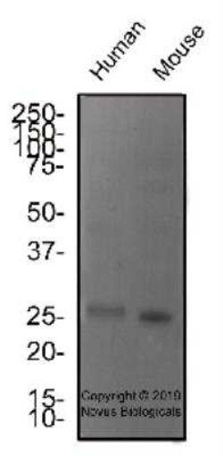 SCP3/SYCP3 Antibody - BSA Free, Novus Biologicals 0.1 mg | Buy Online | Novus Biologicals | Fisher Scientific