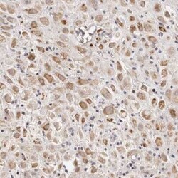 SCUBE2 Antibody, Novus Biologicals 25 &mu;L | Buy Online | Novus Biologicals | Fisher Scientific
