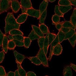 SCX Antibody (PCRP-SCXA-2D11) - Azide and BSA Free, Novus Biologicals 100 &mu;g | Buy Online | Novus Biologicals | Fisher Scientific