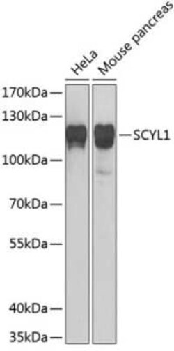 SCYL1 Antibody - BSA Free, Novus Biologicals 0.02 mL; Unconjugated:Antibodies,