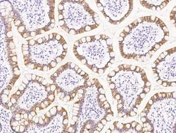 SCYL1BP1 Antibody, Novus Biologicals 100 &mu;g, Unconjugated:Antibodies,