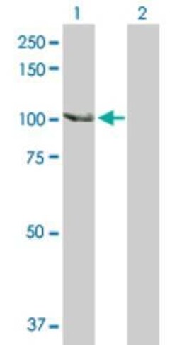 SCYL2 Antibody, Novus Biologicals 0.1 mg | Buy Online | Novus Biologicals | Fisher Scientific