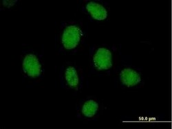 SDCCAG10 Antibody, Novus Biologicals 0.05 mg | Buy Online | Novus Biologicals | Fisher Scientific