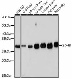 SDHB Rabbit anti-Human, Mouse, Rat, Clone: 9S1A0, Novus Biologicals 100 &mu;g | Buy Online | Novus Biologicals | Fisher Scientific