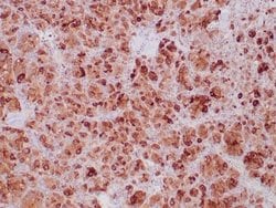 SDHB Antibody (SDHB/6697R) - Azide and BSA Free, Novus Biologicals 100