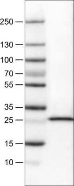 SDHB Antibody (CL0349), Novus Biologicals 0.1 mL, Unconjugated:Antibodies,