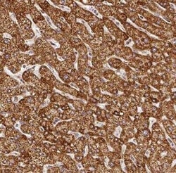 SDHB Antibody, Novus Biologicals:Antibodies:Primary Antibodies