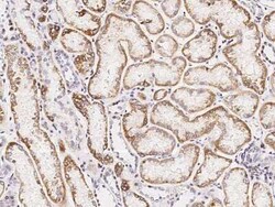 SDHB Antibody, Novus Biologicals 100 &mu;g, Unconjugated:Antibodies, Polyclonal