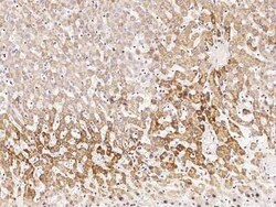 SDHB Antibody, Novus Biologicals 100 &mu;g, Unconjugated:Antibodies, Polyclonal
