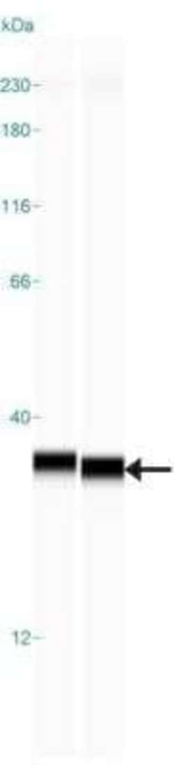 SDHB Antibody, Novus Biologicals:Antibodies:Primary Antibodies