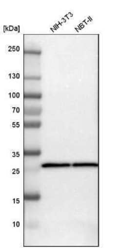 SDHB Antibody, Novus Biologicals:Antibodies:Primary Antibodies
