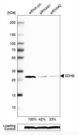 SDHB Antibody, Novus Biologicals:Antibodies:Primary Antibodies