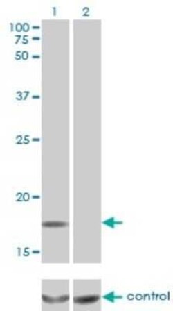 SDNSF/MCFD2 Antibody (3A5-G4), Novus Biologicals 0.1 mg; Unconjugated:Antibodies,