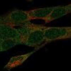 SDR39U1 Rabbit anti-Human, Polyclonal, Novus Biologicals 100 &mu;g | Buy Online | Novus Biologicals | Fisher Scientific