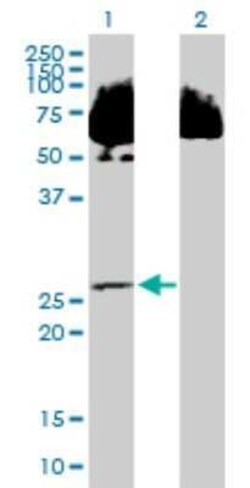 SDR39U1 Antibody, Novus Biologicals 0.05 mg | Buy Online | Novus Biologicals | Fisher Scientific