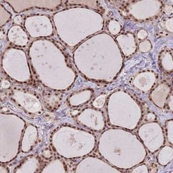 SDS3 Antibody, Novus Biologicals 25 &mu;L, Unconjugated:Antibodies, Polyclonal