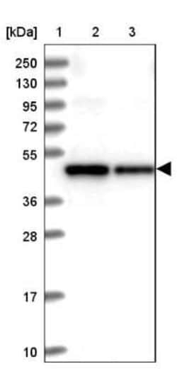 SDS3 Antibody, Novus Biologicals 25 &mu;L, Unconjugated:Antibodies, Polyclonal