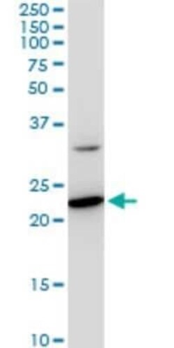 SEC22B Antibody (5A10), Novus Biologicals 0.1 mg | Buy Online | Novus Biologicals | Fisher Scientific