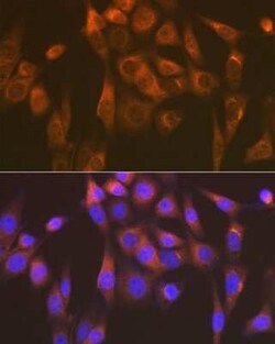 SEC23A Rabbit anti-Human, Mouse, Rat, Clone: 1D4R7, Novus Biologicals 100 &mu;g | Buy Online | Novus Biologicals | Fisher Scientific