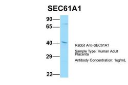 SEC61A Antibody, Novus Biologicals 100 &mu;L | Buy Online | Novus Biologicals | Fisher Scientific