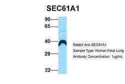 SEC61A Antibody, Novus Biologicals 100 &mu;L | Buy Online | Novus Biologicals | Fisher Scientific