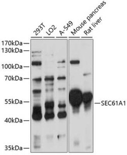 SEC61A Antibody - Azide and BSA Free, Novus Biologicals 0.02 mL; Unconjugated:Antibodies,