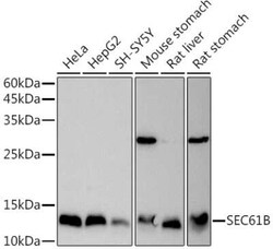 SEC61B Antibody - Azide and BSA Free, Novus Biologicals 0.02 mL; Unconjugated:Antibodies,