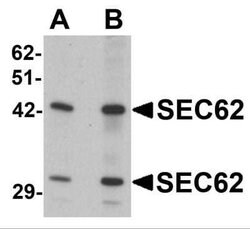 SEC62 Antibody - BSA Free, Novus Biologicals 0.1 mg; Unconjugated:Antibodies,
