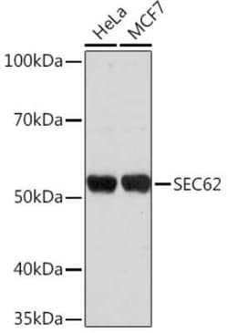 SEC62 Rabbit anti-Human, Polyclonal, Novus Biologicals:Antibodies:Primary