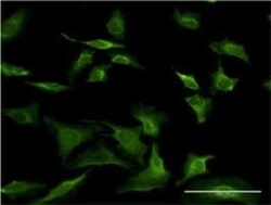 SEC63 Antibody (1A8), Novus Biologicals 0.1 mg | Buy Online | Novus Biologicals | Fisher Scientific