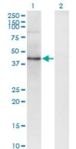 SEC63 Antibody (1A8), Novus Biologicals 0.1 mg | Buy Online | Novus Biologicals | Fisher Scientific