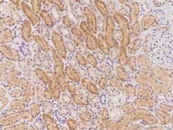 SECISBP2L Antibody, Novus Biologicals 50 &mu;g; Unconjugated:Antibodies,