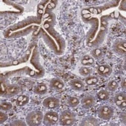 SELI Rabbit anti-Human, Polyclonal, Novus Biologicals:Antibodies:Primary