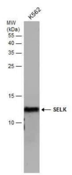 SELK Antibody, Novus Biologicals 100 &mu;g | Buy Online | Bio-Techne | Fisher Scientific