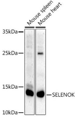 SELK Rabbit anti-Human, Mouse, Polyclonal, Novus Biologicals 20 &mu;g;