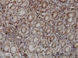 Novus Biologicals SENP6 Antibody (4B7), Novus Biologicals 0.1 mg | Buy Online | Novus Biologicals&trade; | Fisher Scientific