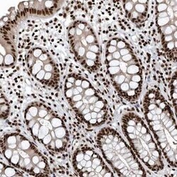 SENP7 Antibody, Novus Biologicals 25 &mu;L | Buy Online | Novus Biologicals | Fisher Scientific